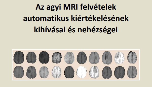 Az agyi MRI felvételek automatikus kiértékelésének kihívásai és nehézségei - Dr. Szilágyi László előadása